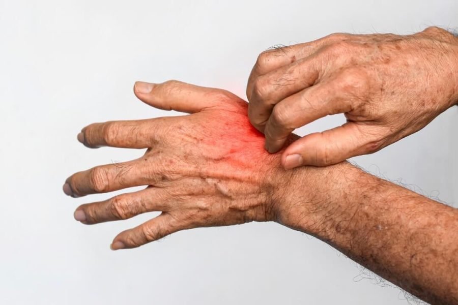 Skin Diseases Symptoms and Ayurvedic Treatment